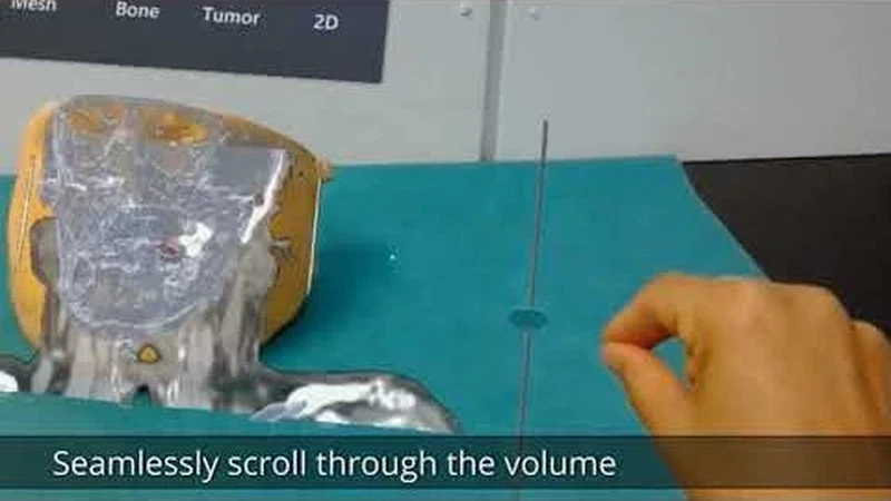 3D Visualization of CT and Segmented Models