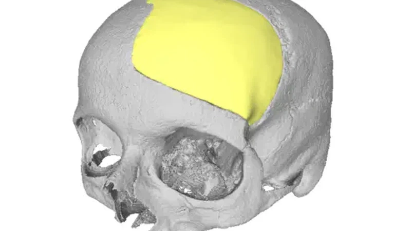 MedShapeNet