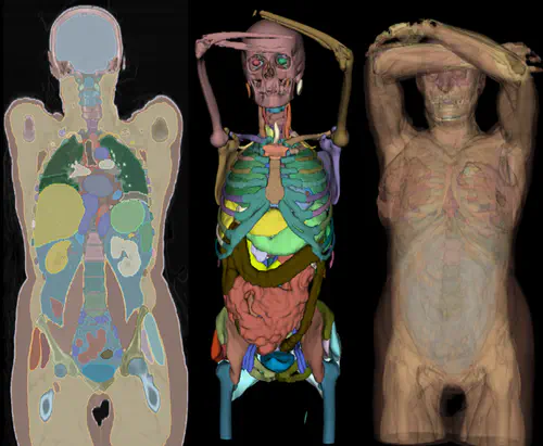 Full Body Anatomy Segmentation