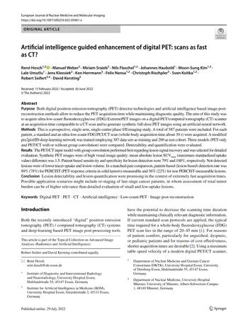 Artificial intelligence guided enhancement of digital PET: scans as fast as CT?