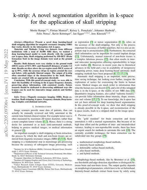 k-strip: A novel segmentation algorithm in k-space for the application of skull stripping