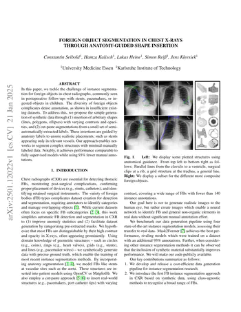 Foreign object segmentation in chest x-rays through anatomy-guided shape insertion