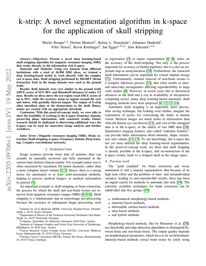 k-strip: A novel segmentation algorithm in k-space for the application of skull stripping